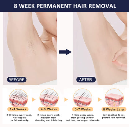 IMENE IPL device, 500K flashes, 5 energy levels, painless home hair removal