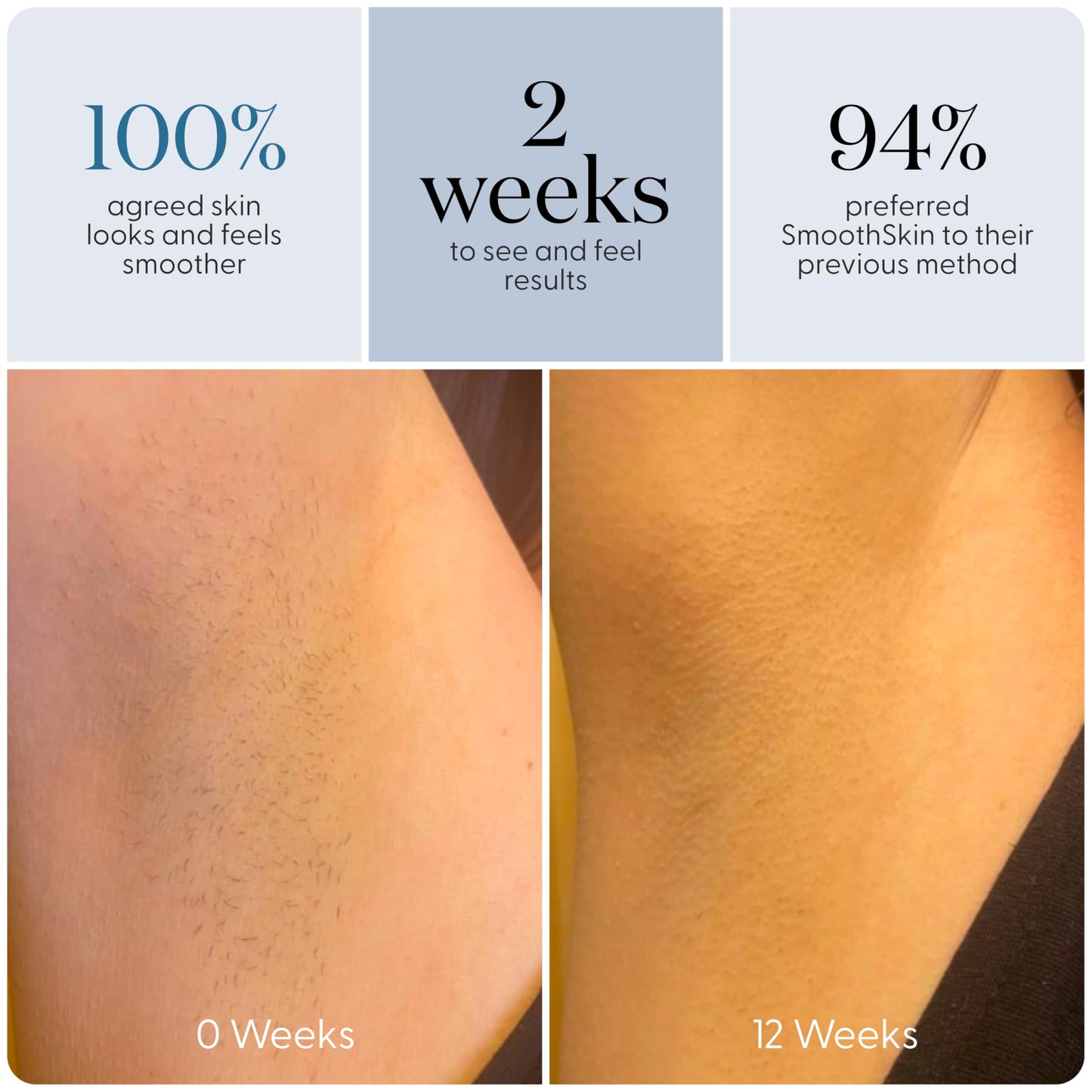 SmoothSkin Pure Adapt IPL, painless, fast results, full body device