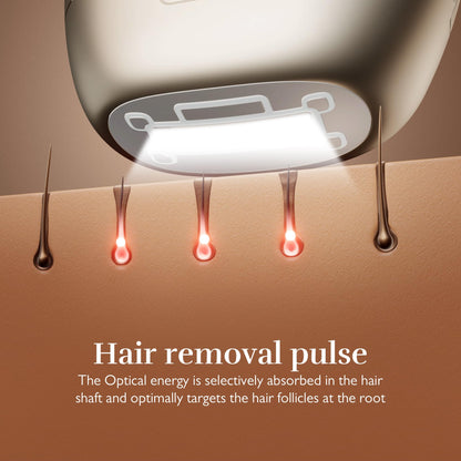 Silk’n 7 IPL Gold, rotating head, smart sensors, quick treatment