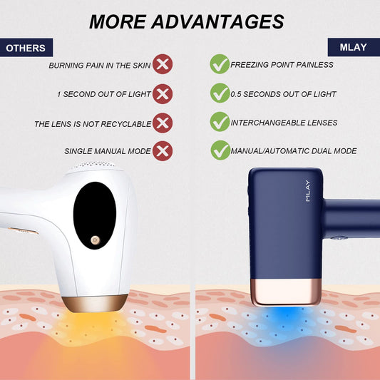 IMENE IPL device, 500K flashes, 5 energy levels, painless home hair removal