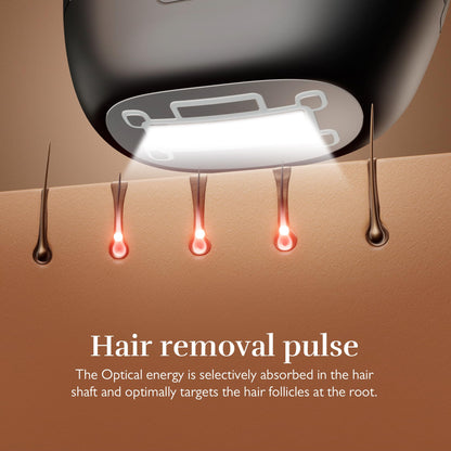 Silk’n 7 IPL device, rotating head, 3 attachments, fast 7-min sessions