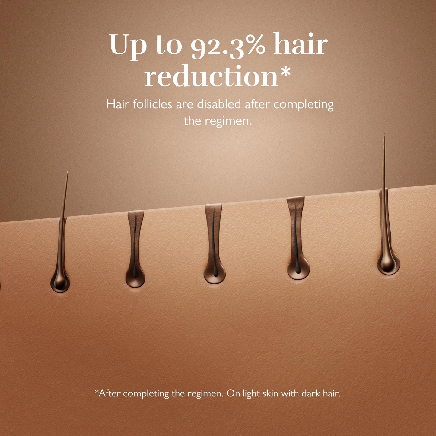 Silk’n 7 IPL device, rotating head, 3 attachments, fast 7-min sessions