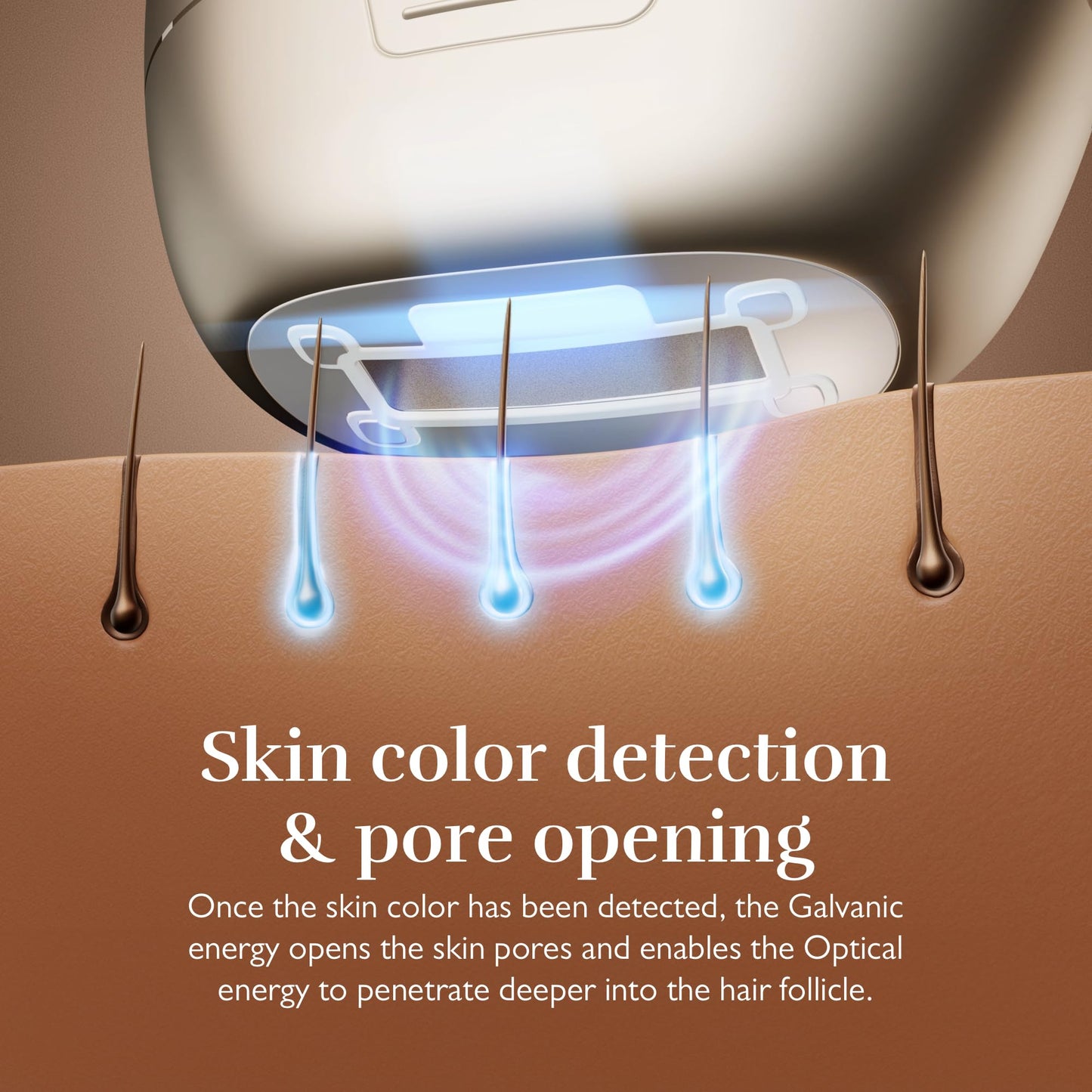 Silk’n 7 IPL Gold, rotating head, smart sensors, quick treatment