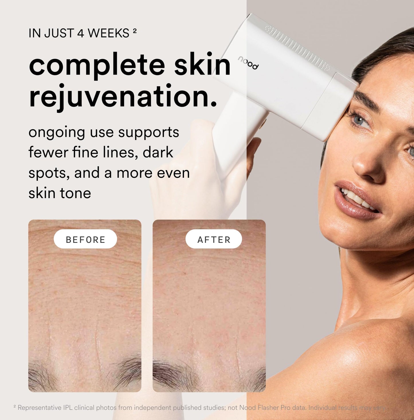 Nood Flasher Pro IPL, red light therapy, painless, long-lasting results